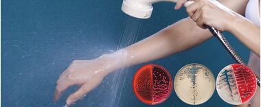 Исследование удаления бактерий с кожи человека